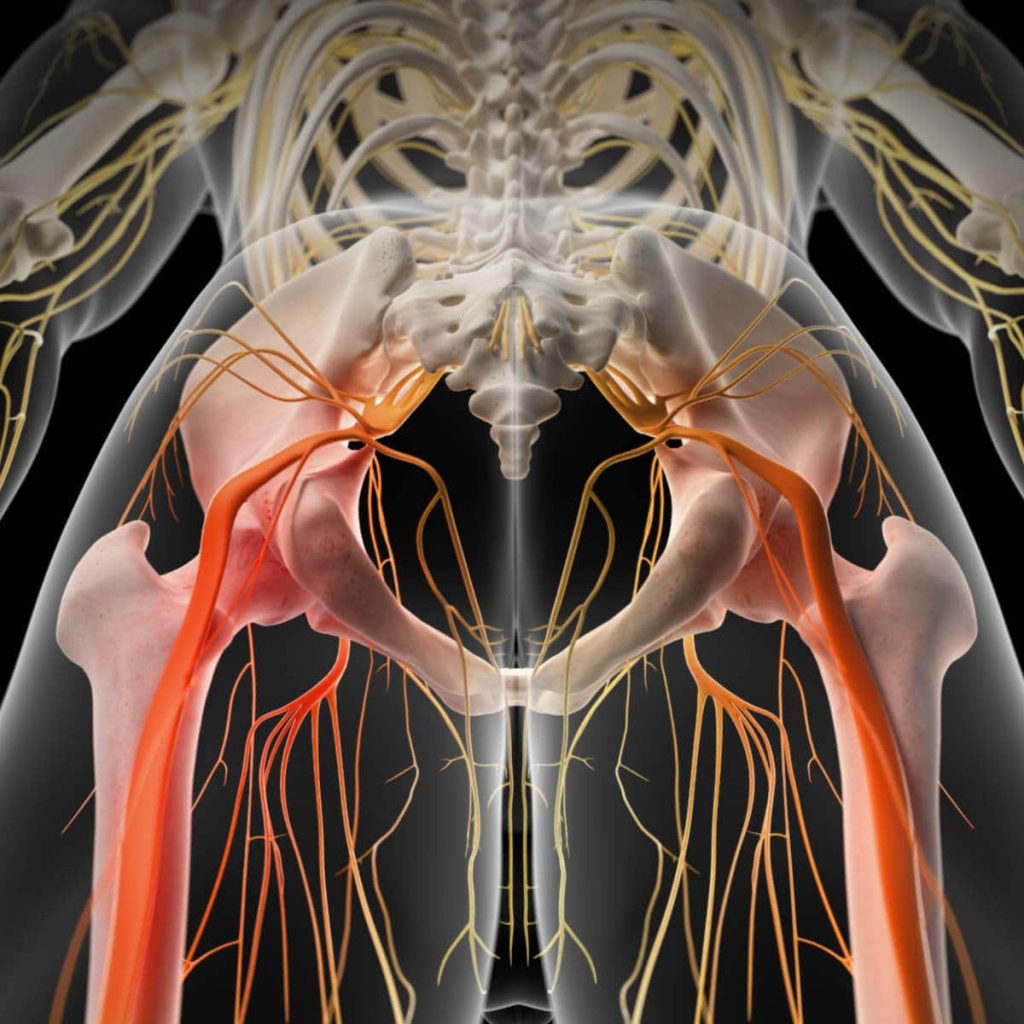 Sciatic nerve pain Pinched Sciatic nerve injury Treatment GoogFI