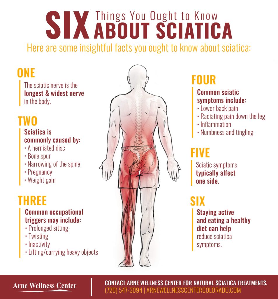 Six Things to Know About Sciatica Infographic 5f3584f97cce1