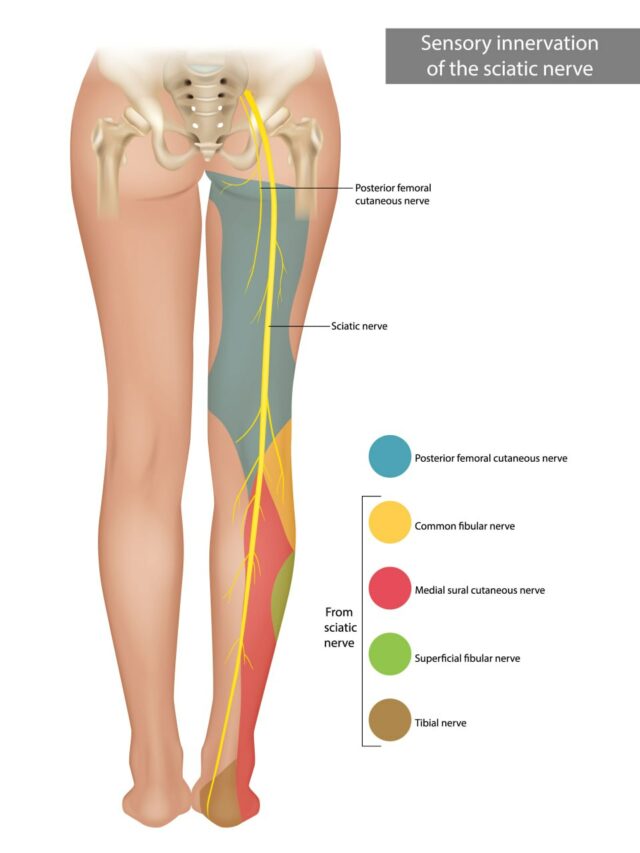 The Sciatic Nerve. Sensory innervation of the sciatic nerve. 640x853 1