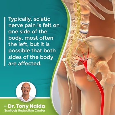 Typically sciatic nerve pain is 400