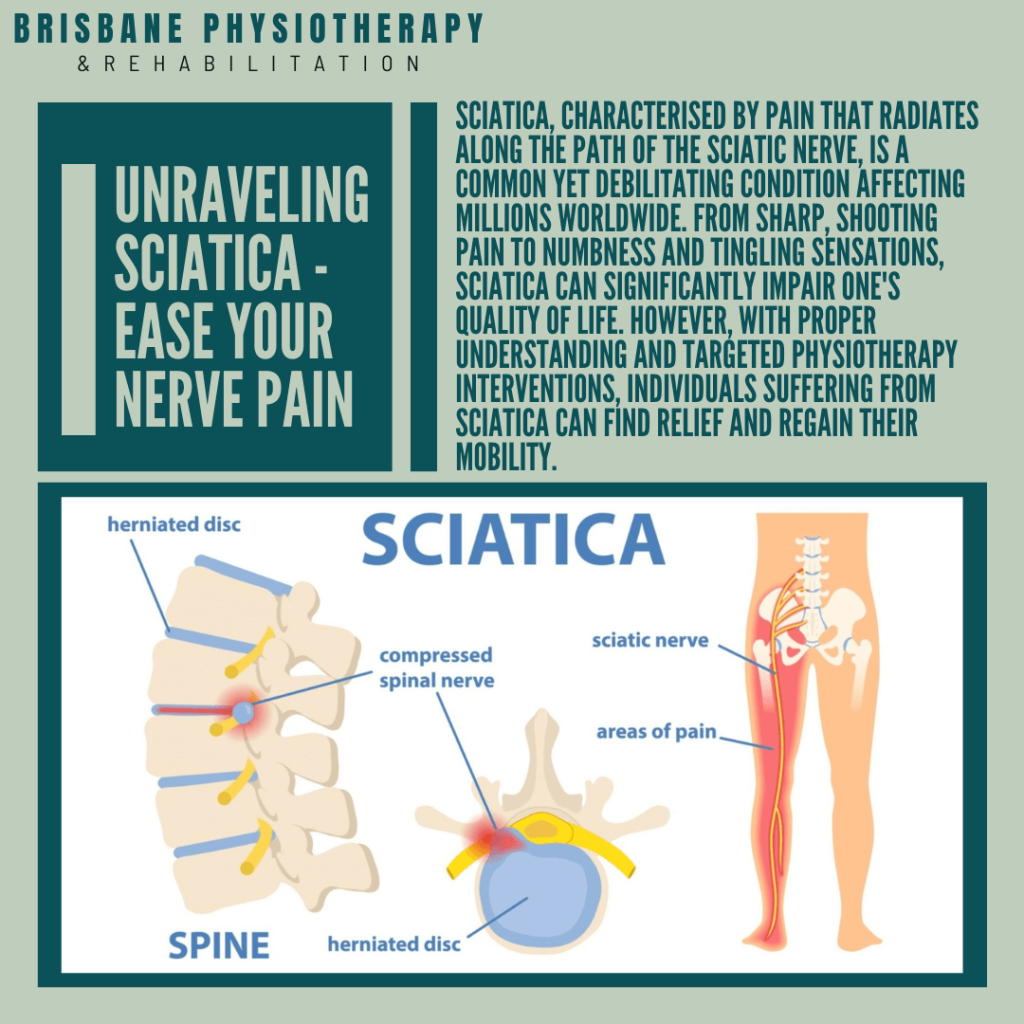 WhatisSciatica