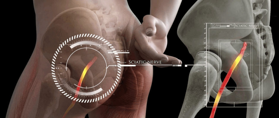 low back pain blog image 02