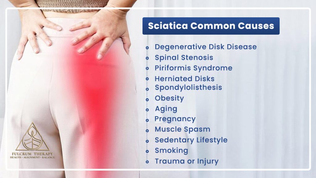 sciatica 11
